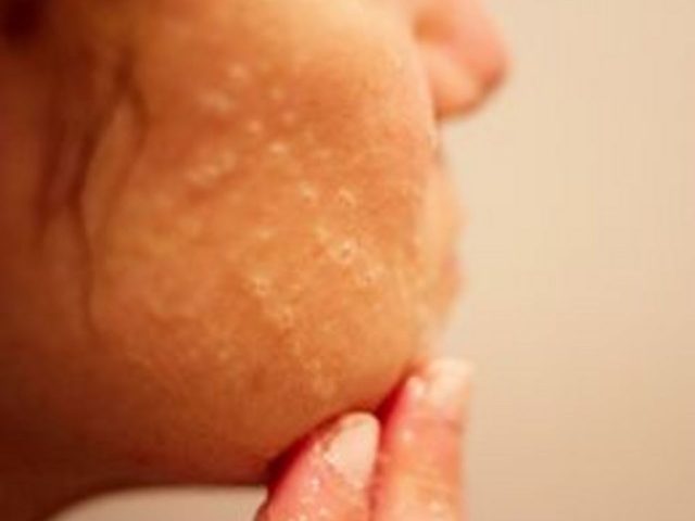 Comment nettoyer les pores du visage Utilisation de remèdes à la maison