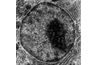 Cellule nucléole - la tache sombre (Institut national de la santé)
